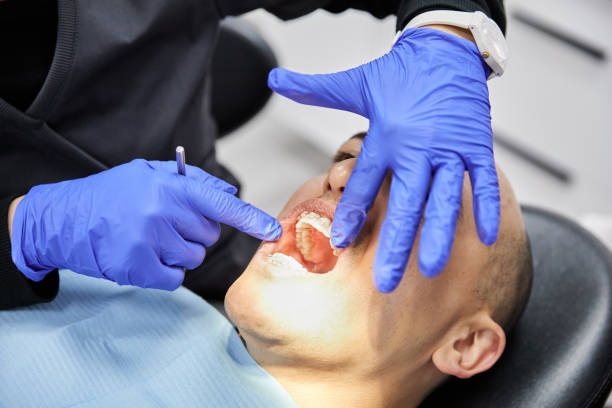 Best Emergency Tooth Extraction in Camp Springs, MD